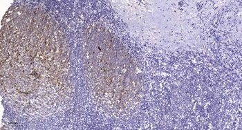 NFκB-p105 (phospho Ser932) rabbit pAb