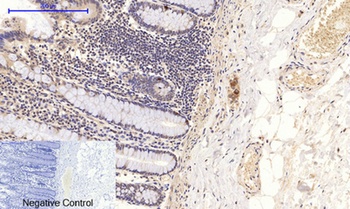 NF kappa B-p65 (phospho-Ser276) antibody