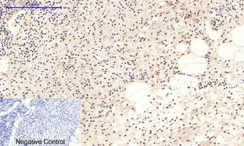 NF kappa B-p65 (phospho-Ser276) antibody