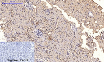 NF kappa B-p65 (phospho-Ser276) antibody