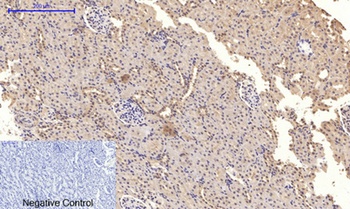 NFκB-p65 (phospho Ser276) rabbit pAb