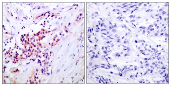 NF kappa B-p65 (phospho-Ser468) antibody