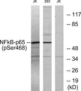 NF kappa B-p65 (phospho-Ser468) antibody