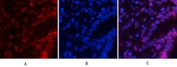 NF kappa B-p65 (phospho-Ser529) antibody