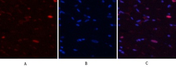 NFκB-p65 (phospho Ser529) rabbit pAb