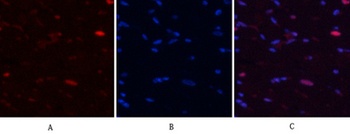 NF kappa B-p65 (phospho-Ser529) antibody