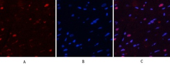 NF kappa B-p65 (phospho-Ser529) antibody