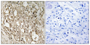 NFκB-p65 (phospho Ser529) rabbit pAb