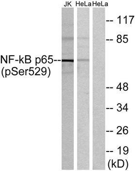 NF kappa B-p65 (phospho-Ser529) antibody