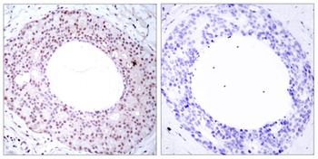 NFκB-p65 (phospho Thr254) rabbit pAb