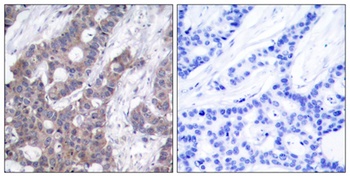 Op18 (phospho Ser16) rabbit pAb