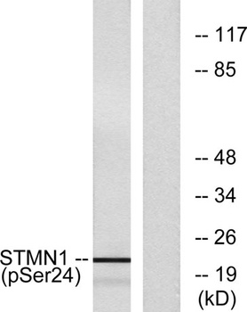 Op18 (phospho Ser25) rabbit pAb