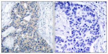 Op18 (phospho Ser38) rabbit pAb