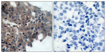 p21 (phospho-Thr145) antibody