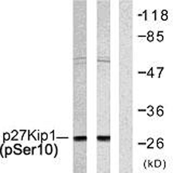 p27 (phospho-Ser10) antibody