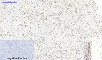 p38 (phospho Thr180) rabbit pAb