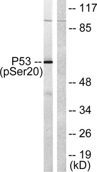 p53 (phospho-Ser20) antibody