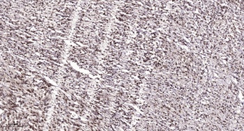 p53 (phospho Ser20) rabbit pAb
