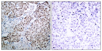 p53 (phospho Ser315) rabbit pAb