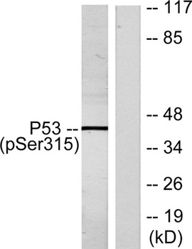 p53 (phospho-Ser315) antibody