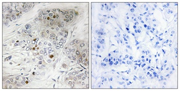 p53 (phospho-Ser9) antibody