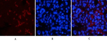 p53 (phospho-Thr18) antibody