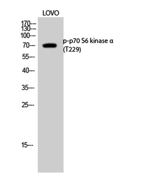 p70 S6 kinase alpha (phospho-Thr229) antibody