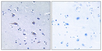 p70 S6 kinase α (phospho Thr229) rabbit pAb
