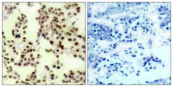 p73 (phospho-Tyr99) antibody