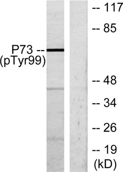 p73 (phospho-Tyr99) antibody