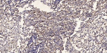 Paxillin (phospho-Tyr31) antibody