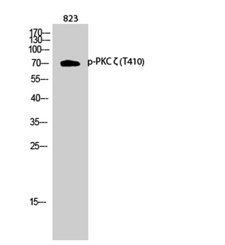 PKC zeta (phospho-Thr410) antibody
