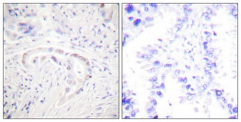 PKC ζ (phospho Thr410) rabbit pAb