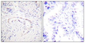 PKC zeta (phospho-Thr410) antibody