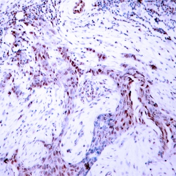 PR (phospho Ser190) rabbit pAb