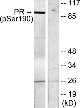 PR (phospho Ser190) rabbit pAb