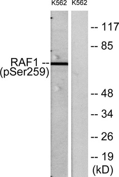 Raf-1 (phospho Ser259) rabbit pAb