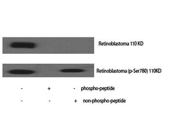 Rb (phospho-Ser780) antibody