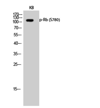 Rb (phospho-Ser780) antibody