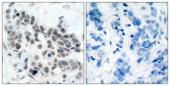 Rb (phospho-Ser780) antibody