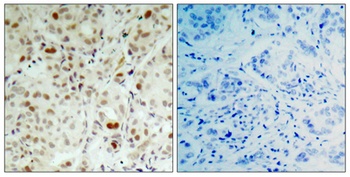 Rb (phospho Ser807) rabbit pAb