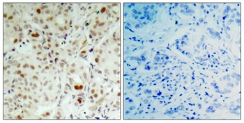 Rb (phospho-Ser807) antibody