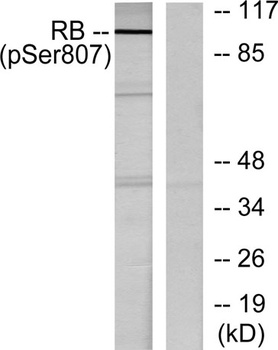 Rb (phospho Ser807) rabbit pAb