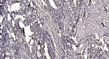Shb (phospho Tyr246) rabbit pAb