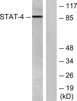 Stat4 (phospho Tyr693) rabbit pAb