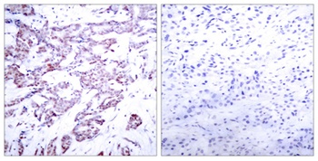 Stat6 (phospho Thr645) rabbit pAb