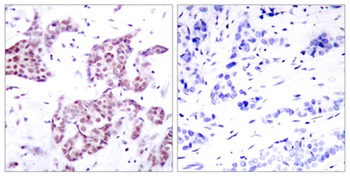 Stat6 (phospho Tyr641) rabbit pAb