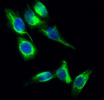 Tau (phospho Ser396) rabbit pAb