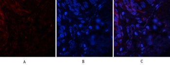 Tau (phospho-Ser396) antibody