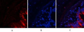 Tau (phospho-Ser396) antibody